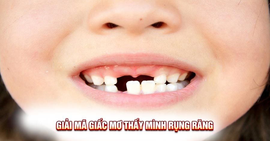 Khám Phá Bí Ẩn Mơ Thấy Mình Rụng Răng: Điềm Báo Gì?